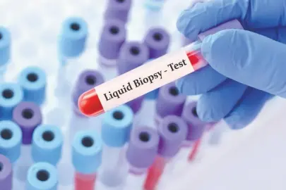 Kanserde likit biyopsi dönemi