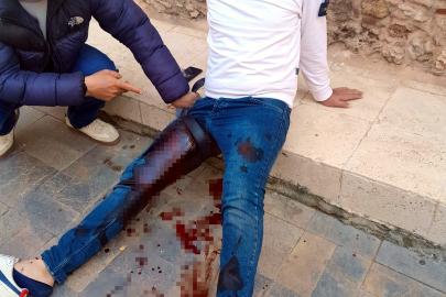 Tartıştığı butik sahibine pompalı tüfekle saldırdı: 3 yaralı