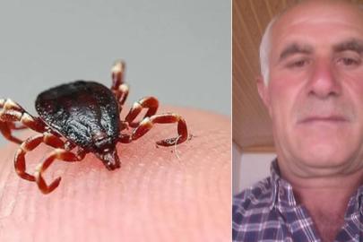 Vücuduna yapışan keneyi kendi çıkardı, 4 gün sonra öldü